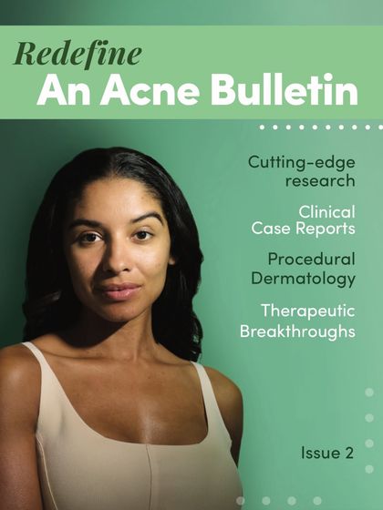 Featured in "Redefine: An Acne Bulletin". This is the cover of the medical bulletin featuring my case study, highlighting my contribution to clinical dermatology and cutting-edge acne research.