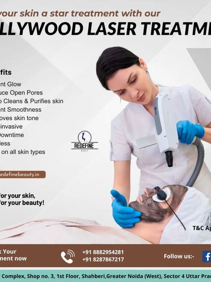 The Hollywood Laser Treatment, another name for the Carbon Laser Peel, is a star treatment for an instant glow with no downtime. This graphic lists its benefits, including being non-invasive, painless, and safe for all skin types.