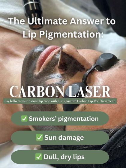 The Carbon Laser is the ultimate answer to lip pigmentation. It's highly effective for smokers' pigmentation, sun damage, and hormonal darkening, helping to restore your natural lip tone.