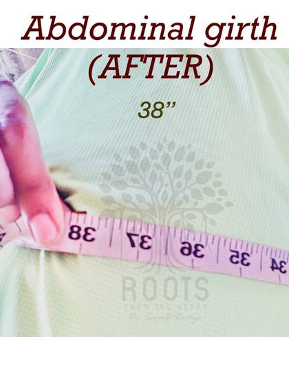 After: The abdominal girth reduced to 38 inches. This inch loss is a crucial sign of improved metabolic health, not just weight reduction.