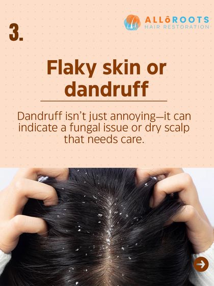 Flaky skin or dandruff is more than just an annoyance. It can indicate a fungal issue or a severely dry scalp that requires targeted care to resolve.