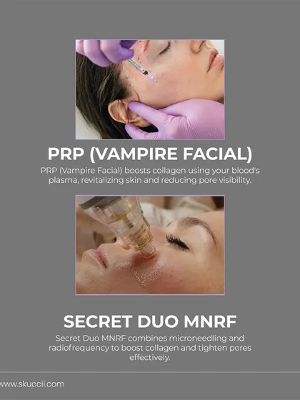 For concerns like open pores, I use a variety of treatments. PRP, also known as a Vampire Facial, uses your own plasma to boost collagen and revitalize skin, while Secret Duo MNRF combines microneedling with radiofrequency to tighten pores effectively.