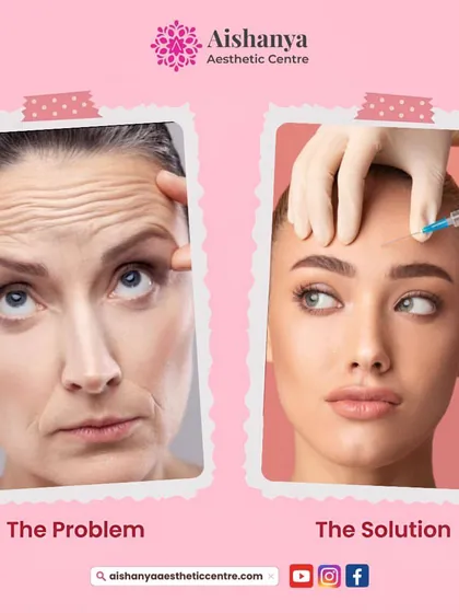 The problem: wrinkles and expression lines that make you look tired. The solution: a targeted injectable treatment that relaxes the muscles causing these lines. This simple graphic illustrates how I address the root cause of wrinkles.
