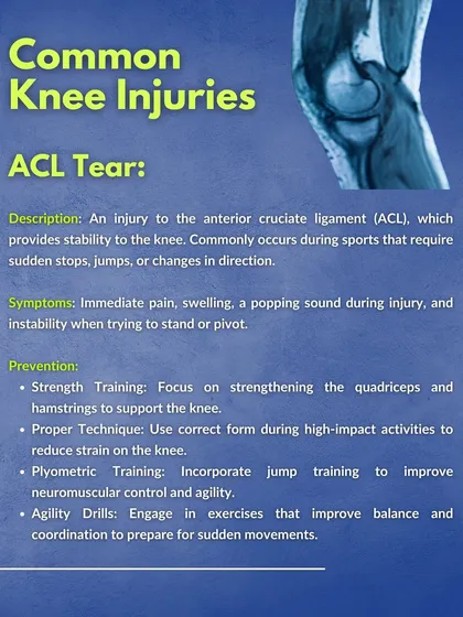 A detailed look at a common knee injury: the ACL tear. This infographic describes the injury, its symptoms, and prevention strategies like strength training, proper technique, and plyometrics.