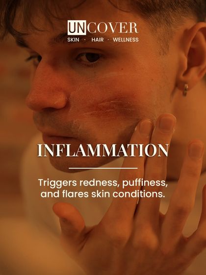 Sugar causes inflammation in the body, which can show up on your skin as redness, puffiness, and flare-ups of conditions like rosacea or eczema.