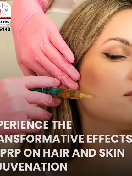 This image shows a Platelet-Rich Plasma (PRP) treatment in progress. A fine needle is used to deliver the PRP, derived from your own blood, into the skin to stimulate collagen and promote natural healing and rejuvenation from within.