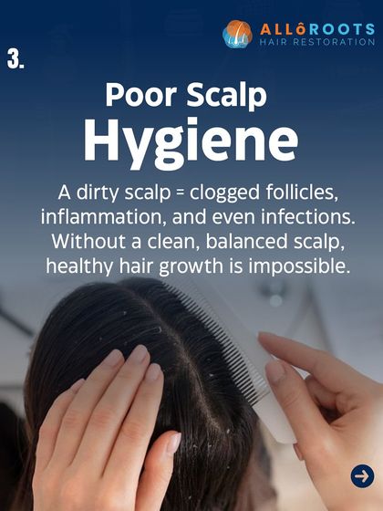 Poor scalp hygiene is another trigger for hair loss. A dirty scalp leads to clogged follicles, inflammation, and even infections. Without a clean, balanced scalp, healthy hair growth is impossible.