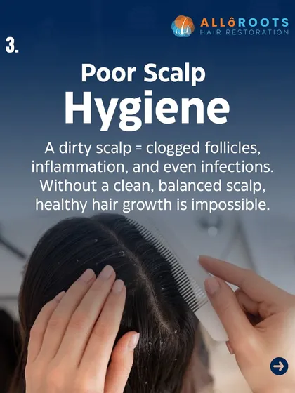 Poor scalp hygiene is another trigger for hair loss. A dirty scalp leads to clogged follicles, inflammation, and even infections. Without a clean, balanced scalp, healthy hair growth is impossible.