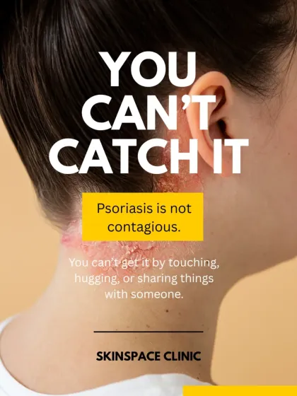 It is a crucial myth to bust: psoriasis is not contagious. It is an autoimmune condition, and you cannot catch it from someone. I believe in educating the community to reduce the stigma associated with it.