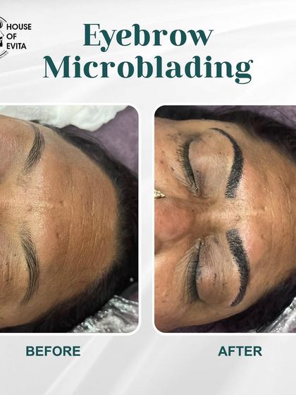 A dramatic before-and-after of Microblading on a client with very sparse brows. The result is a full, beautifully shaped set of brows that look completely natural.