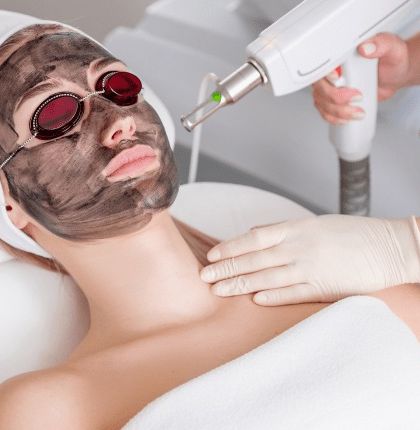 Here you can see a Carbon Laser Peel in progress. This treatment is one of my favorites for providing an instant brightening effect, shrinking pores, and improving overall skin tone and texture.