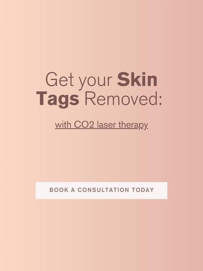 If you're ready to get your skin tags removed, CO2 laser therapy is an excellent, safe, and effective option. A consultation is the first step to achieving smoother skin.