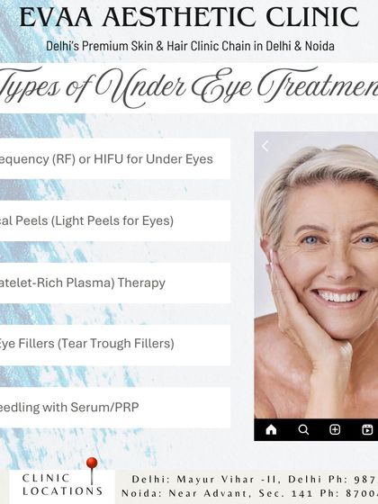Explore our range of under-eye treatments designed to address specific concerns, including Radiofrequency, chemical peels, PRP, and tear trough fillers.