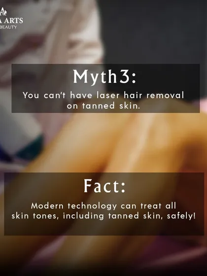 Myth: You can't have laser hair removal on tanned skin. Fact: While it's best to avoid tanning, modern lasers like the one I use can safely treat all skin tones, including tanned skin, with the right settings.
