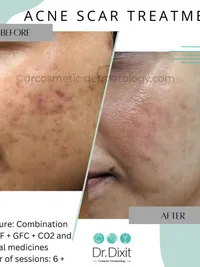 Skin Brightening & Pigmentation Correction