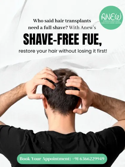 A common concern with hair transplants is the need to shave the entire head. My Shave-Free FUE technique allows me to perform the transplant by working between your existing hair, so you can restore your hairline discreetly without a drastic change to your current style.