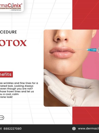 An infographic detailing the benefits of Botox. It is highly effective at minimizing wrinkles and fine lines, helping you look refreshed and relaxed rather than angry or tired.