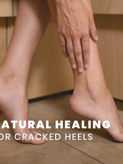 I offer natural, holistic healing for cracked heels. By combining specific Ayurvedic treatments with a personalized diet plan, I address the root cause of the issue for long-lasting comfort.
