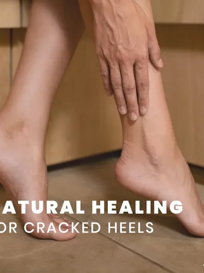 I offer natural, holistic healing for cracked heels. By combining specific Ayurvedic treatments with a personalized diet plan, I address the root cause of the issue for long-lasting comfort.