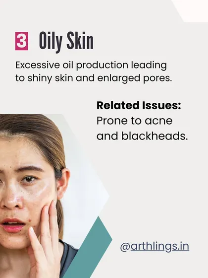Oily skin is caused by excessive oil production, which leads to a shiny appearance and enlarged pores. It is often more prone to acne and blackheads.