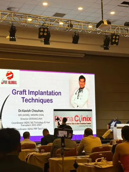 Sharing knowledge is key to advancing our field. Here I am presenting on Graft Implantation Techniques at the FUE Global World Congress, sharing insights with leading hair transplant surgeons from around the world.