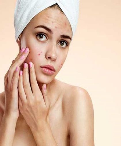 Acne is one of the most common reasons people visit a dermatologist. If you are struggling with breakouts, know that effective medical treatments are available. You don't have to manage it alone.