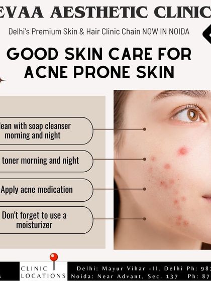 A guide to good skincare for acne-prone skin, emphasizing the importance of cleansing, toning, using acne medication, and moisturizing.