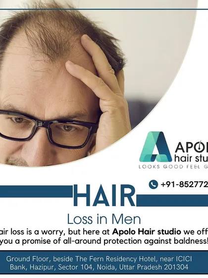 Hair loss in men is a common concern, but it doesn't have to be a permanent problem. We offer a promise of all-around protection against baldness with our expert solutions.