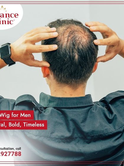 A client examining his hair loss. I offer a free, private consultation to understand exactly what you're looking for and to explain how a hair wig or patch can help.