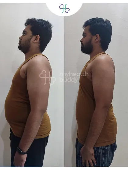 Gowtham lost 12 kgs in 12 weeks. His side profile shows a significant reduction in belly fat, achieved by learning to balance his diet without giving up his favorite foods.