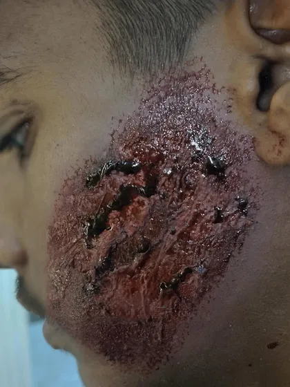 Creating realistic facial wounds requires incredible attention to detail. This prosthetic claw mark was designed to look fresh and raw, perfect for a close-up shot in an action sequence or a horror film.