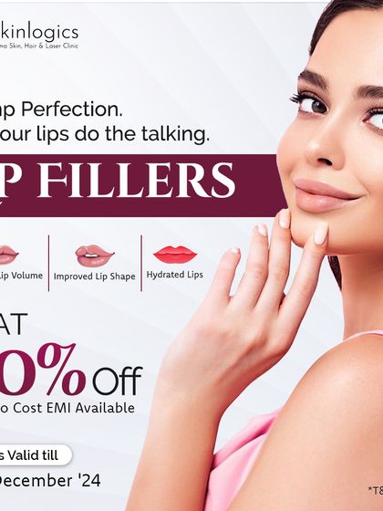 Let your lips do the talking with our Lip Filler offer. Get a flat 30% off to enhance lip volume, improve shape, and achieve perfectly hydrated, plump lips.