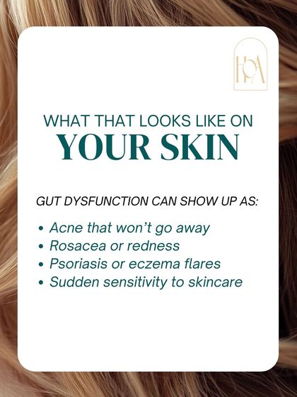 Gut dysfunction can show up on your skin in many ways. This includes acne that won't go away, rosacea or redness, psoriasis or eczema flares, and even a sudden sensitivity to skincare products you've used for years.