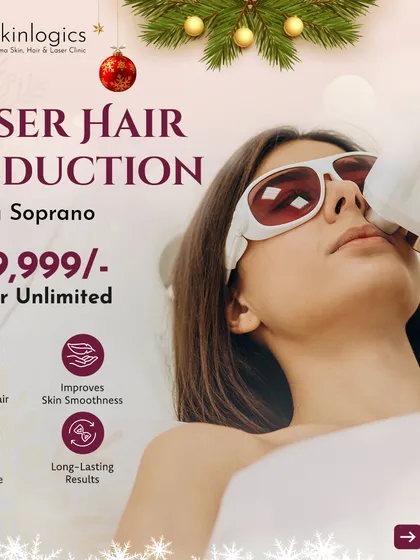 Our New Year special offers a full year of unlimited laser hair reduction sessions with the advanced Alma Soprano machine. This is the ultimate package for anyone committed to achieving and maintaining completely smooth, hair-free skin.