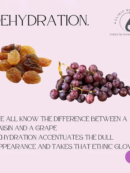Bad Habit: Dehydration. Just like the difference between a grape and a raisin, dehydration accentuates dullness and takes away your skin's natural glow.