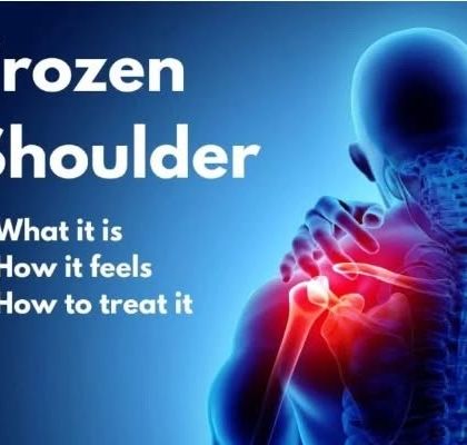 Frozen shoulder is a condition that causes significant stiffness and pain. This graphic outlines what it is, how it feels, and the treatment approaches I use to restore mobility and reduce discomfort.