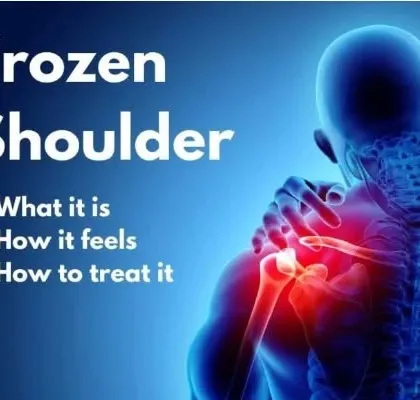 An informational graphic explaining what a frozen shoulder is, how it feels, and how it can be treated through physiotherapy.