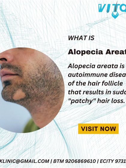 Vitals Klinic - Hair Restoration & Treatment Treating Scalp Conditions photo 3