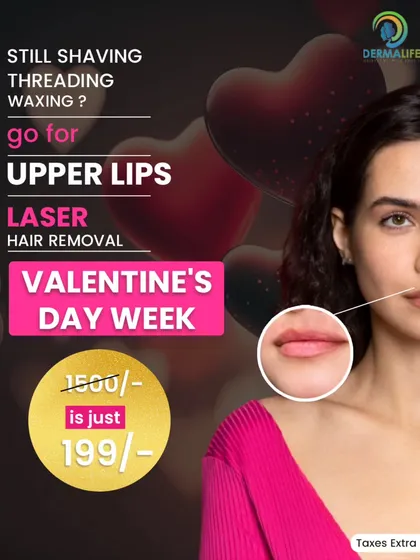 If you are tired of threading or waxing your upper lips, this is a great way to try our advanced laser treatment. This service targets the hair follicle directly, leading to a significant reduction in hair growth over a few sessions, giving you smooth skin.