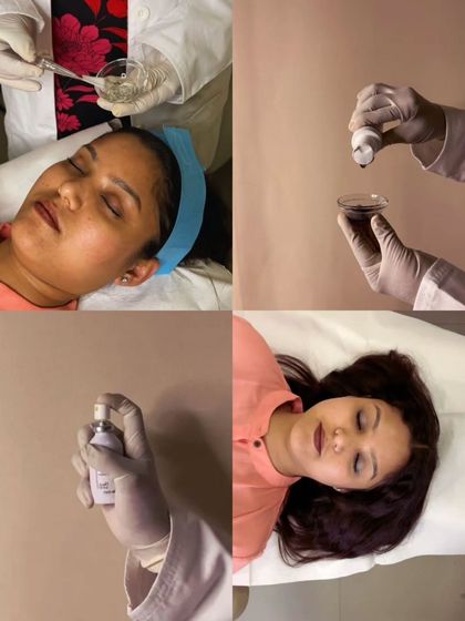 This collage showcases the key steps of a lip peel treatment, from preparing the peel solution to the careful application and post-treatment care, all designed to combat dryness and pigmentation.