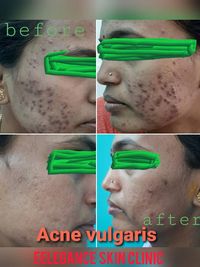 Aesthetic Dermatology