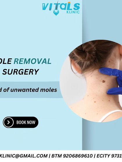 Vitals Klinic - Dermatosurgery (Minor Procedures) Mole, Skin Tag & Growth Removal photo 3