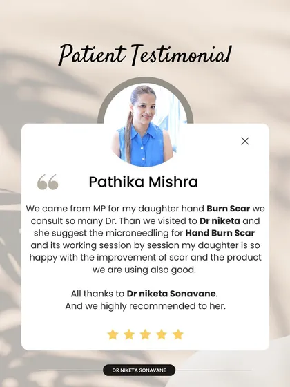 This family came all the way from MP for their daughter's burn scar. Seeing her happiness with the improvement after microneedling is incredibly fulfilling.