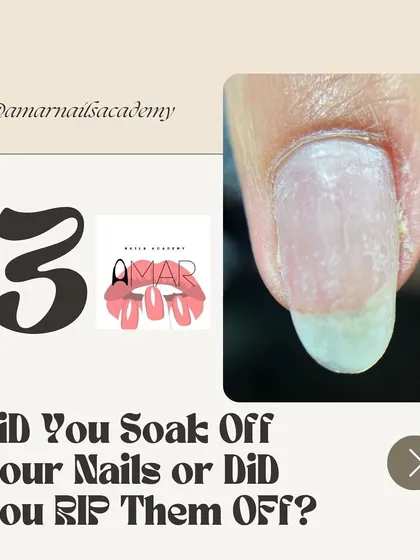 "You ruined my nails!" Let's talk about it. Often, damage comes from improper removal. Did you soak them off correctly, or did you rip them off?