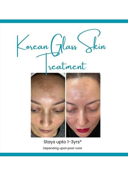 This graphic highlights the long-lasting results of my Korean Glass Skin treatment, which can stay for up to 1-3 years.