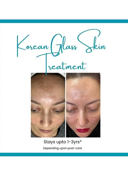 This graphic highlights the long-lasting results of my Korean Glass Skin treatment, which can stay for up to 1-3 years.