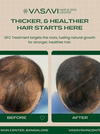 Hair Loss & Regrowth Treatment