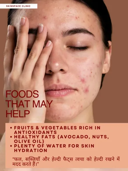 On the other hand, some foods can help. A diet rich in antioxidants from fruits and vegetables, healthy fats from avocados and nuts, and plenty of water for hydration can support healthier skin.