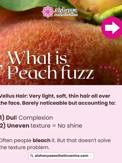 This graphic explains "peach fuzz," the very fine hair on the face that can contribute to a dull complexion and uneven texture. Dermaplaning is the perfect solution to remove it, unlike bleaching which doesn't solve the texture problem.
