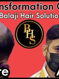 Hair Wigs for Men & Women